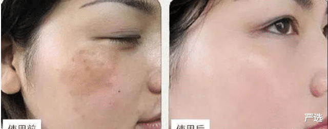 西虹市首富 药店有一种“ 佑颜膏”，皮肤越擦越好，关键不贵，遇到别错过