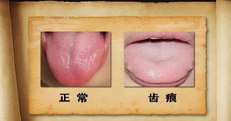 养生|养生“每天8杯水”，医生：这两类人喝，就错了