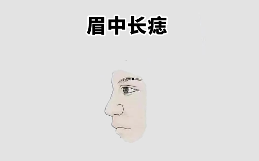中国易经风水 “万里挑一的5颗痣”，一个不差钱，一个有人帮，升官发财不用愁！