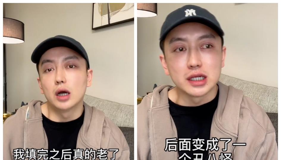 整容|男网红花钱整容成毁容，哭诉脂肪填充后变丑八怪，20岁似中年大叔