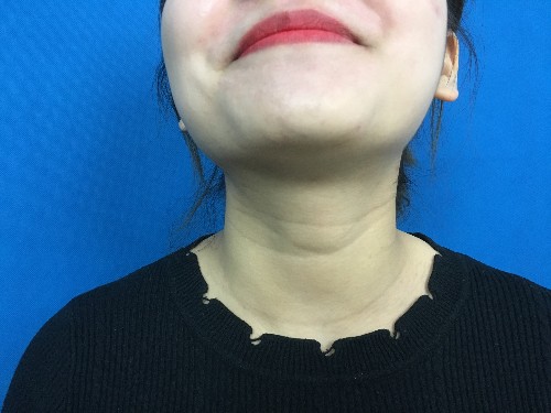 |体内有癌,身体会有哪些异常表现?建议提前排查这3种症状