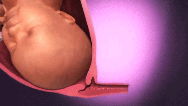 C妈学堂|产妇生孩子疼得撕心裂肺时,胎儿是什么感受?看完内心五味杂陈