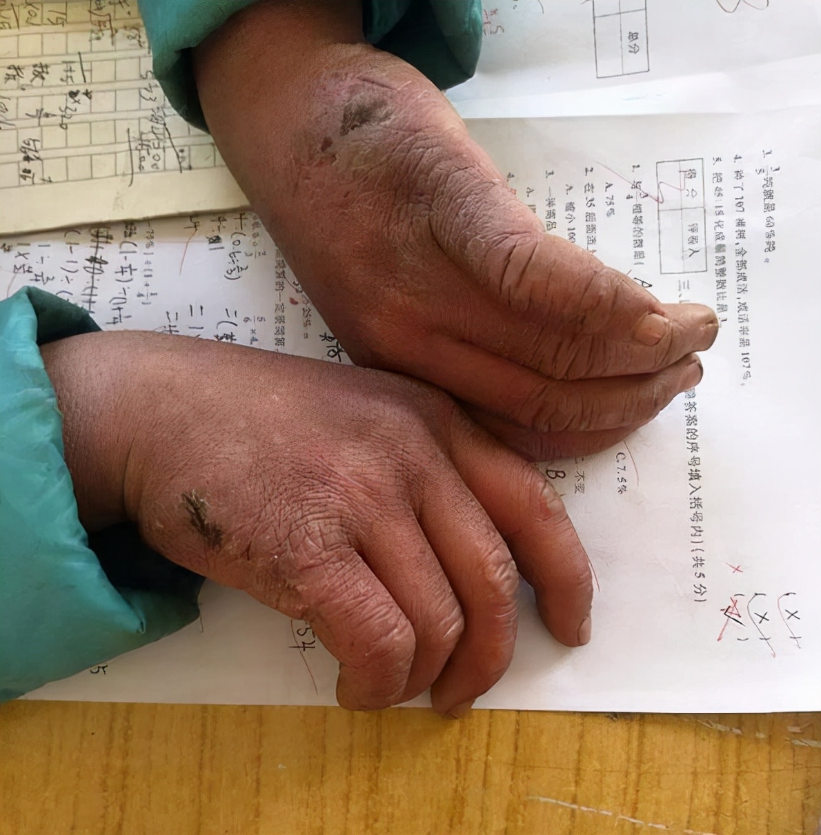 3年前每天走9公里山路上下学,满头冰碴子的王福满,现如今怎么样