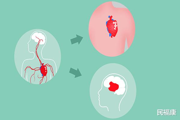 民福康|心脏不好，静养和坚持运动，该选择哪一个更好？