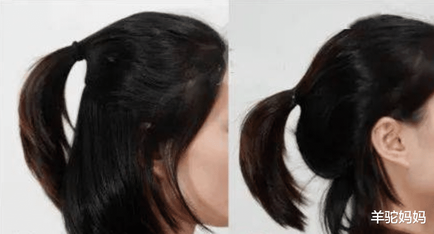 羊驼妈妈|“只需2.8万让娃头型变美”,这套头盔火了,容貌焦虑请放过孩子