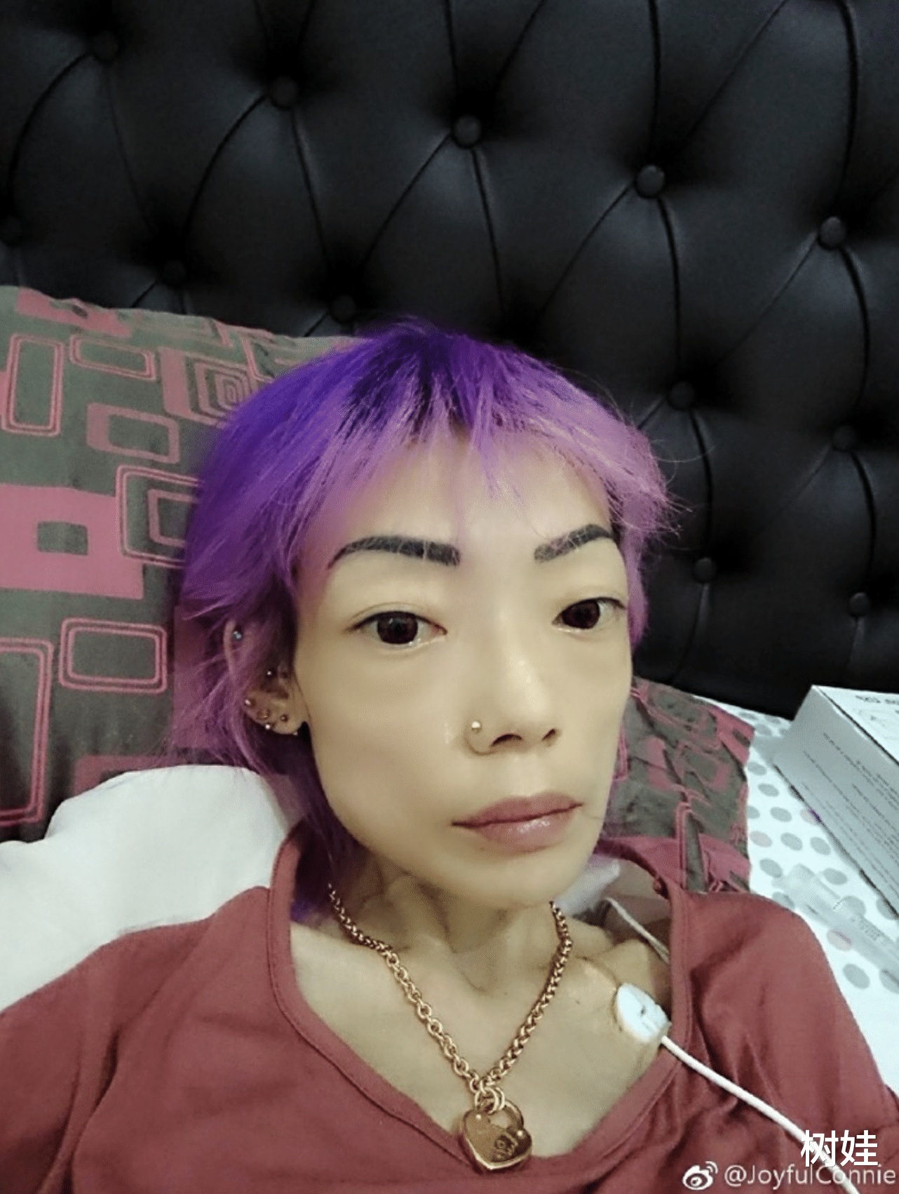 赵雅芝|郭永淳前妻罕露脸精神尚可，仍暴瘦如柴，靠拍卖名牌赚钱筹医药费