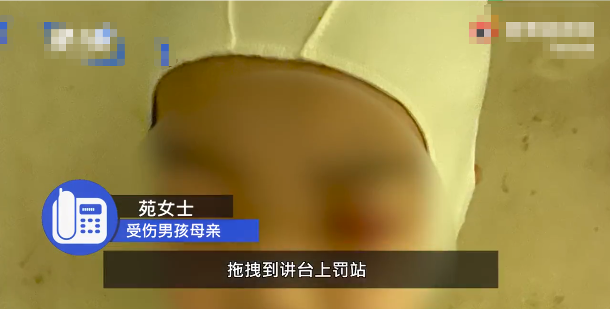 视野新闻周刊 河南9岁男童因上课讲话遭老师体罚，导致头皮头骨分离，校方：与学校无关