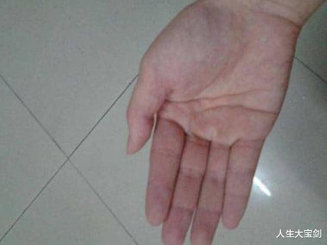 |如果男生的肾功能不好,一般手上有这三个标志,如果发现就要节制