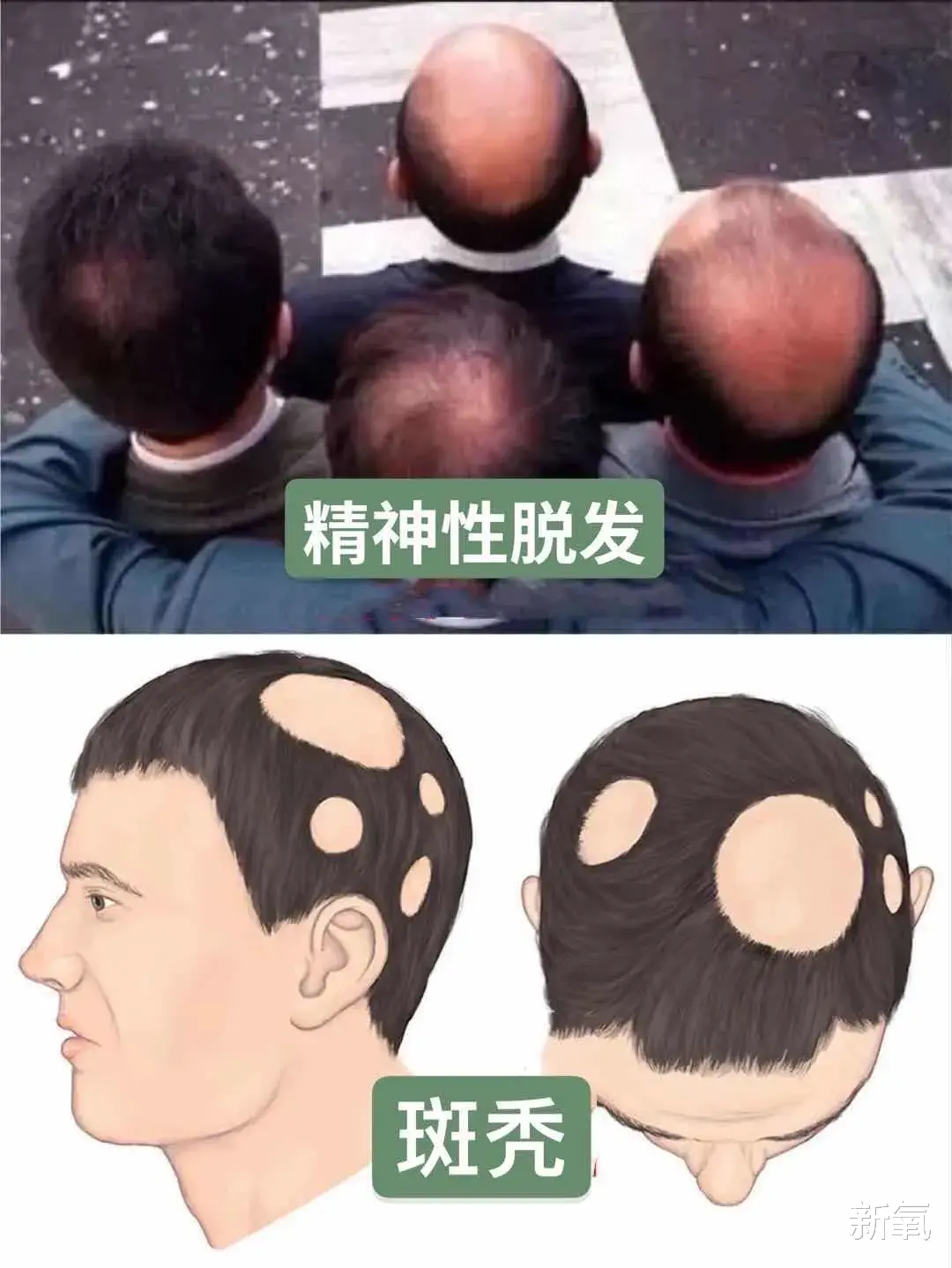 明星|为什么18岁的惊艳美少年40岁全变成油腻猥琐大叔？