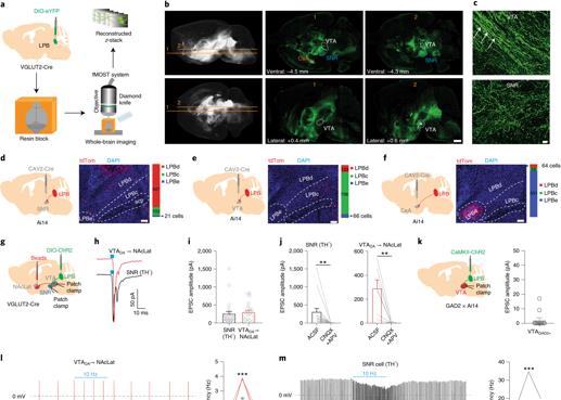 空间站 疼痛影响大脑中多巴胺活动（fMOST技术再次助力神经环路研究）