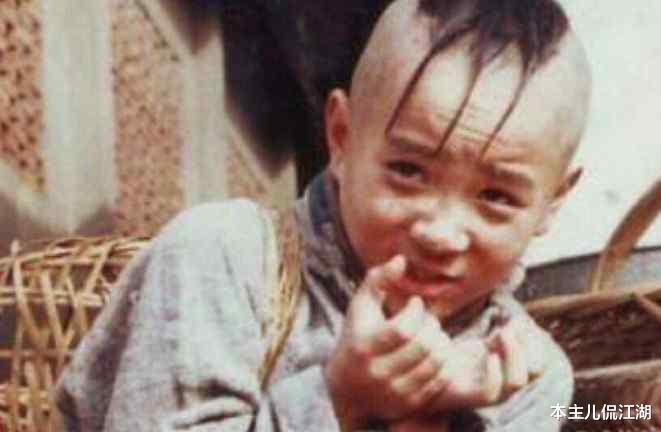 孟智超|“三毛”34岁了！8岁爆火，14岁谢顶，植发挨300多针，如今变帅哥