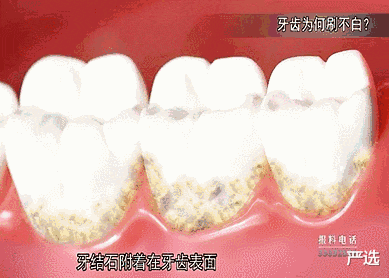 严选 牙膏行业还有国产吗？中华牙膏姓“中”，却“被迫”与英国人分钱