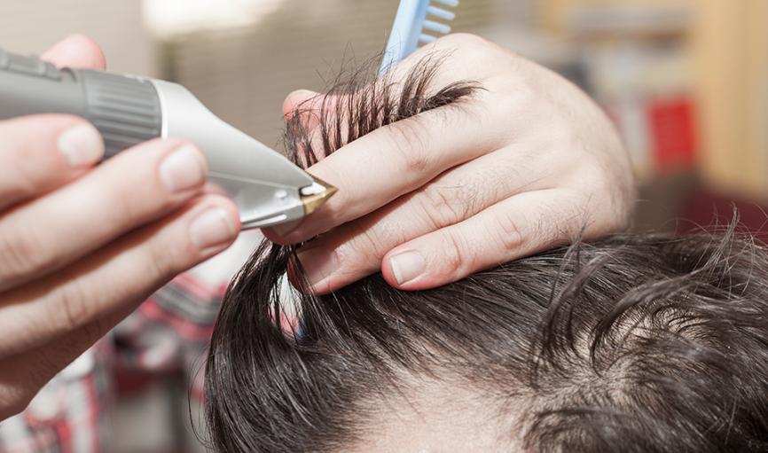 脱发|这些脱发谣言你也信！难怪错失了生发良机