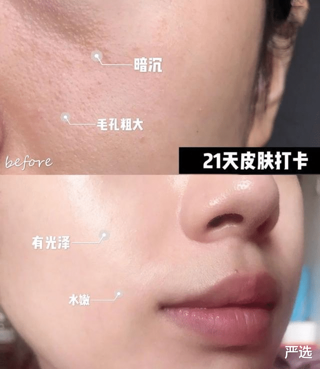 严选|连续打了6年“美白针”的女人，如今怎么样了？网友：难以置信