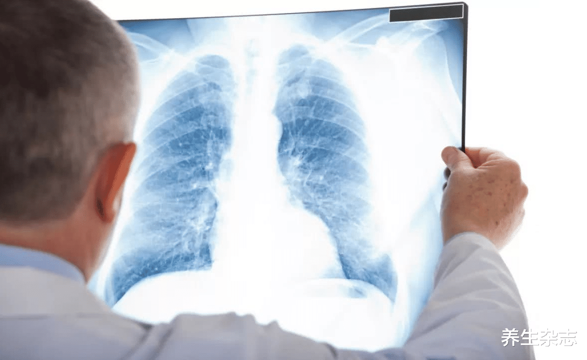 |呼吸科主任:开水中扔一把,没事天天坚持喝,冲走结节,肺感激你