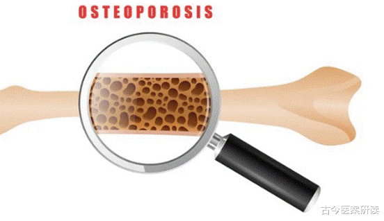 骨密度|吃一口等于喝8碗大骨汤,医生:你若天天吃,骨密度蹭蹭上涨,到老也不怕摔