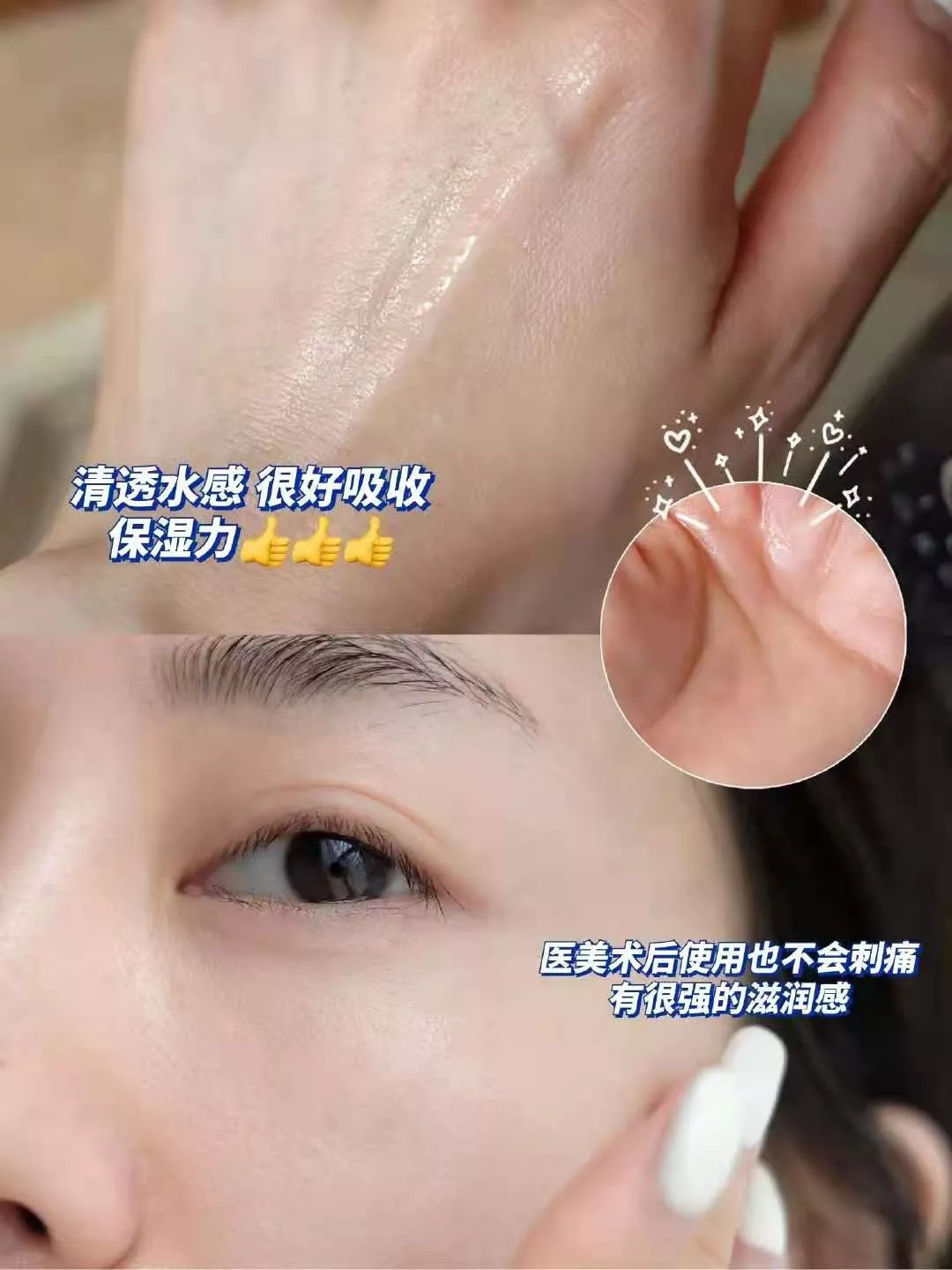 碳水化合物 韩剧女神宣布结婚，可吸引我的是31岁的她，依然满脸胶原蛋白