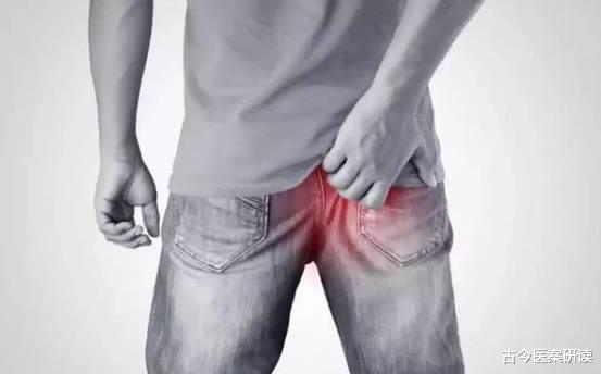 古今医案研读|“菊花”一疼，痔疮更严重，医生：养成好习惯能自愈！