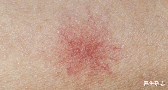 肝脏|吃一片胜于5斤枸杞，医生建议：没事敞开吃，肝脏可“百毒不侵”