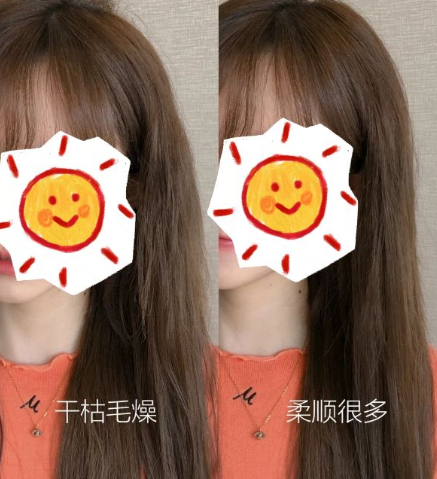 头皮屑|三款孕妇洗发水被拉入黑名单，起屑严重还脱发，大家要谨慎购买