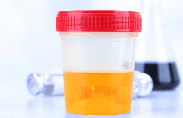 尿蛋白|尿蛋白迟迟未转阴，是药不对症？4个原因全剖析让肾功能稳一点