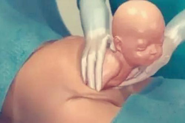 怀孕妈妈知识宝典|八张图详解剖腹产手术全过程 看完真的好心疼女人