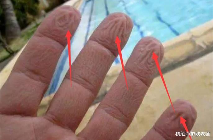 面膜 别小看敏感肌，它很可能来自你的面膜！