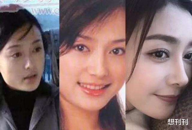 整容|无孔不入！整容脸是如何毁掉各种电视剧的？