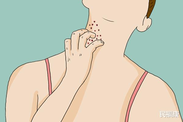 皮肤瘙痒|为什么一到冬天皮肤就容易瘙痒?有什么预防和缓解的方法?