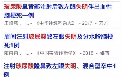 美容 美容院有哪些常见的坑?去消费前,这些套路你最好了解一下!
