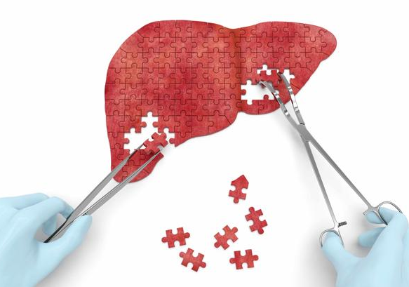 健康周谈|乙肝患者流鼻血是不好的预兆？医生：或与这些原因有关，请多留心