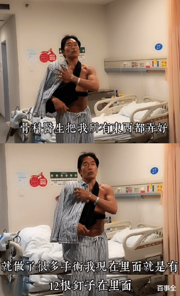 郑浩南|56岁郑浩南近况！独自住院无人照顾显凄凉，做手术钉12根钉子