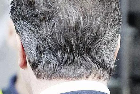 白发|白发长在哪，病从哪出？白发长在两鬓、额前和后脑勺，代表什么？