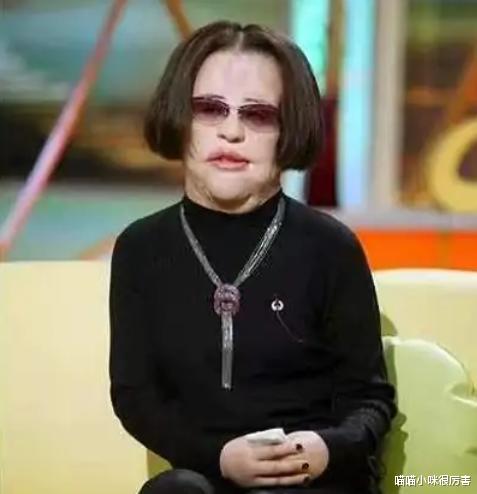 邵音音|年轻时惊为天人,整容后却颜值崩塌,这3位女明星,容貌变化大