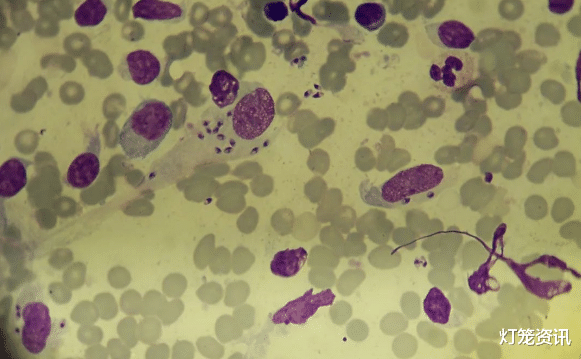 耳念珠菌 继“超级真菌”袭击美国后，科学家警告：食人肉的寄生虫正在蔓延