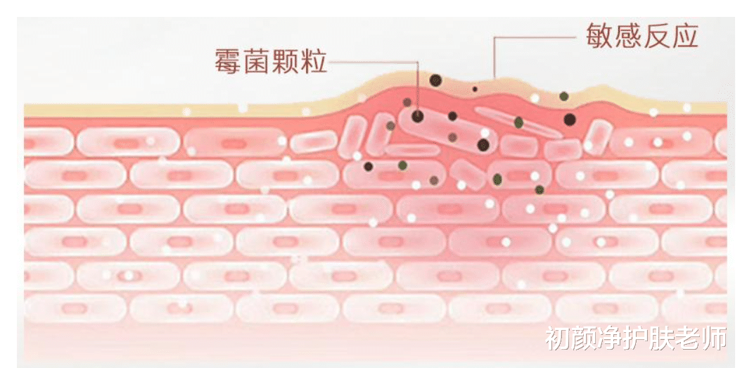面膜 敏感肌可以敷面膜吗？敏感肌怎么敷面膜才正确？