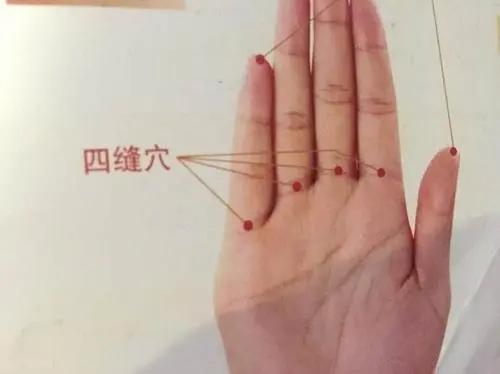 铠甲护士|肠胃好不好,手上能看出来吗?那么手上都有哪些表现呢?