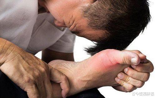 痛风|痛风“根源”已找到,羊肉排在倒数,医生:不想肾衰找上门,趁早戒掉