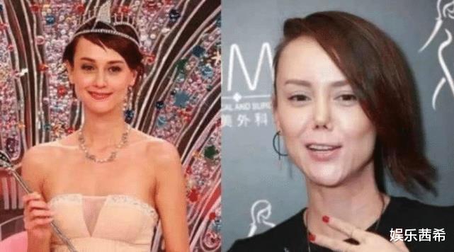 整容|沦为整容牺牲品的5位女星前途尽毁，有的执迷不悟，有的悔不当初