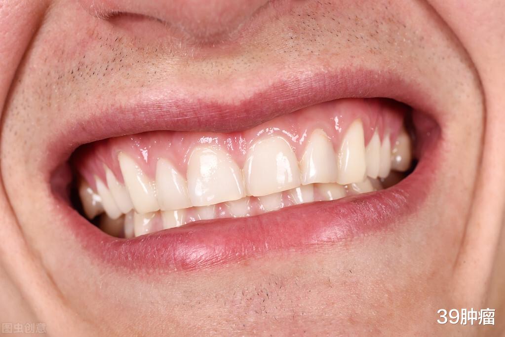 39肿瘤 人到中年,牙齿松动是必然还是偶然?终于有了答案,原因在“它”