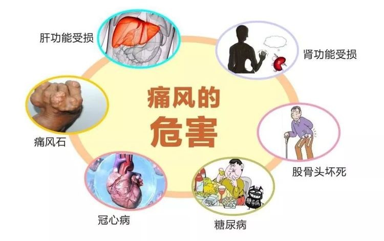 尿酸|?肾衰大多是“拖”出来的，身体4处“异常”没准肾已衰竭，尽早检查