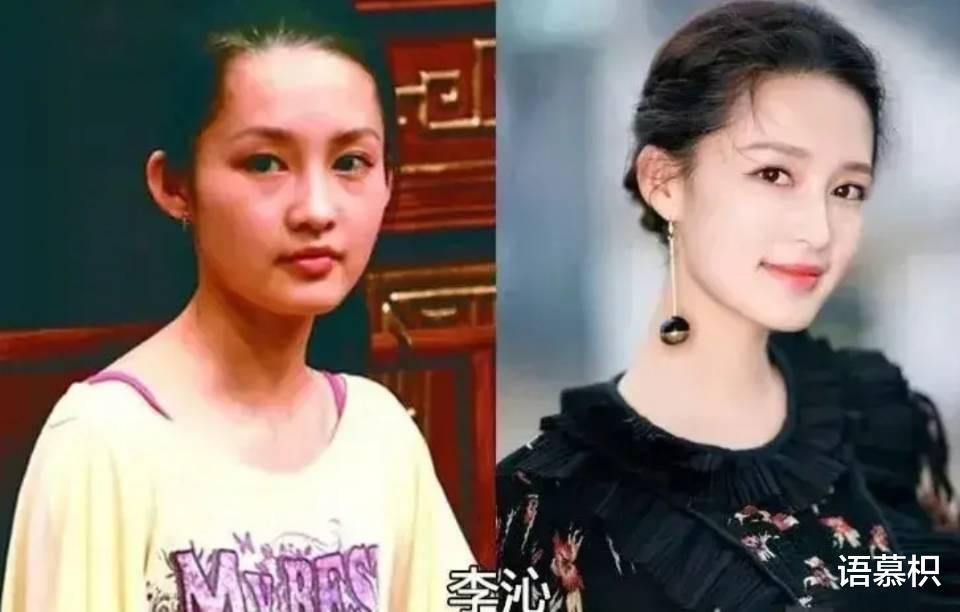 娱乐圈|娱乐圈就是整容场？开挂式逆袭？明星出道前后对比，你认出了几个