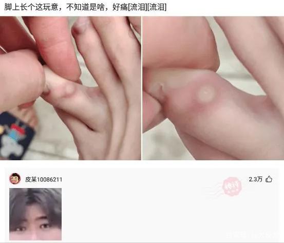 神经元 神回复：海水很咸不能喝！那海洋动物是怎么喝到淡水的