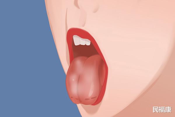 饮食|火气大、胸闷、四肢酸痛，体内湿气太重，要如何祛湿？