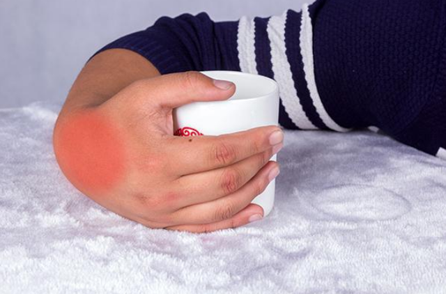 痛风|“嘌呤大户”被揪出，少吃避免痛风，同时多吃这2水3物