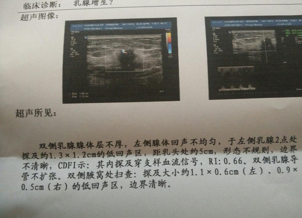 医生|医生：拿到体检报告时，小心“结节”二字，日常做好预防很重要
