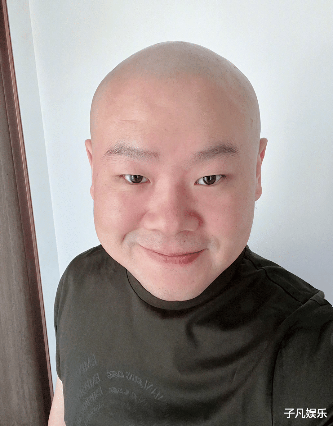 天上有个太阳 岳云鹏宣布工作暂停，现状曝光，身体不适需要恢复令人心疼！