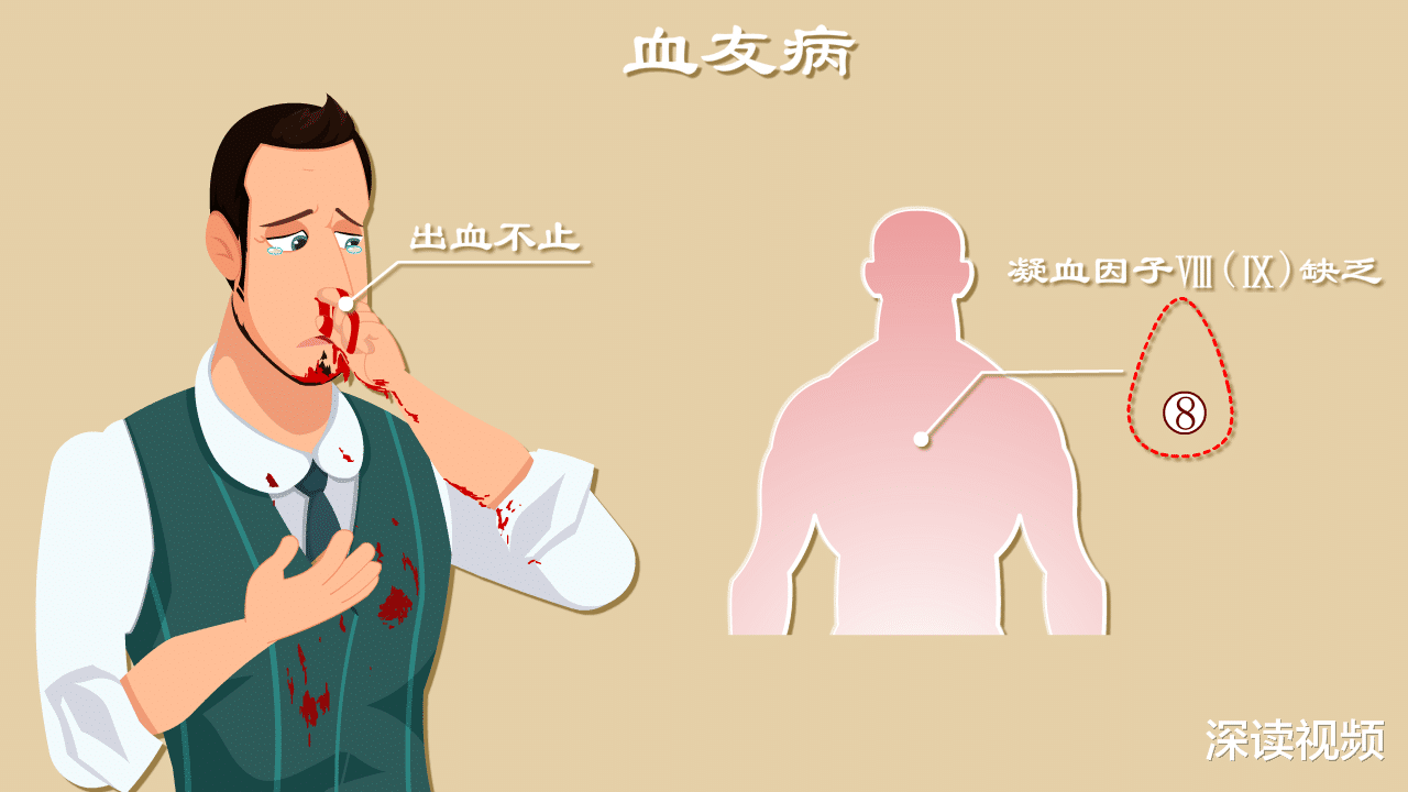 鼻血止不住?一查竟是血友病?咋回事?血友病发病机制动漫版,燃