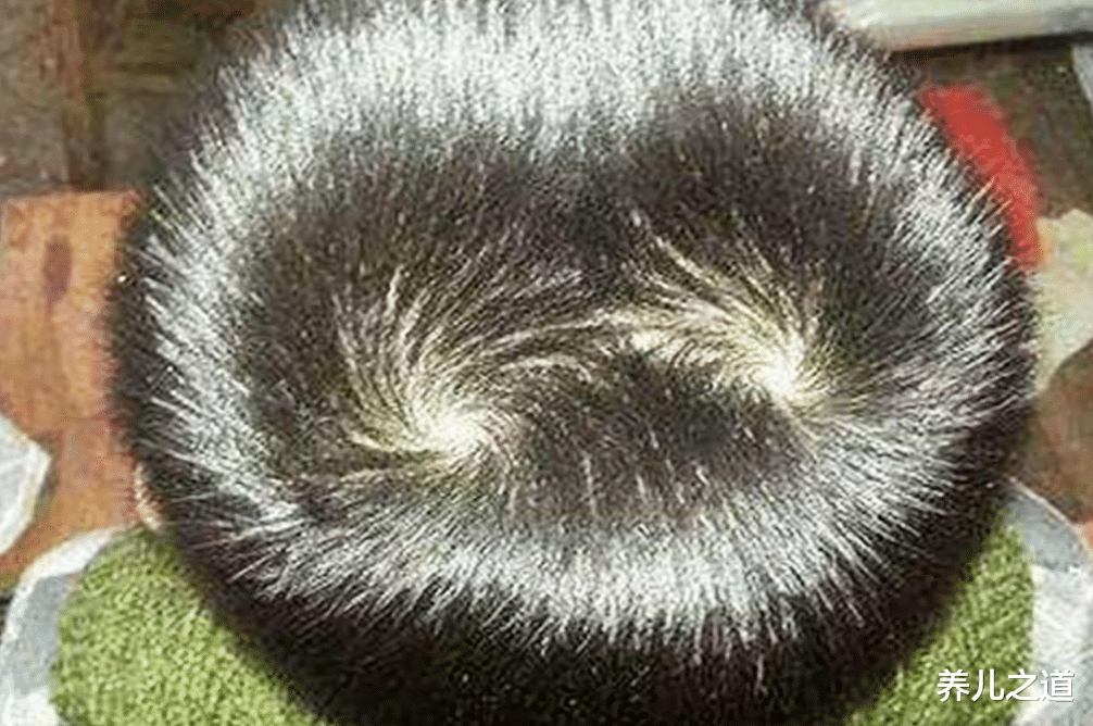 养儿之道|孩子多旋与一旋，两者的区别是啥？头旋多的孩子智商会更高吗？