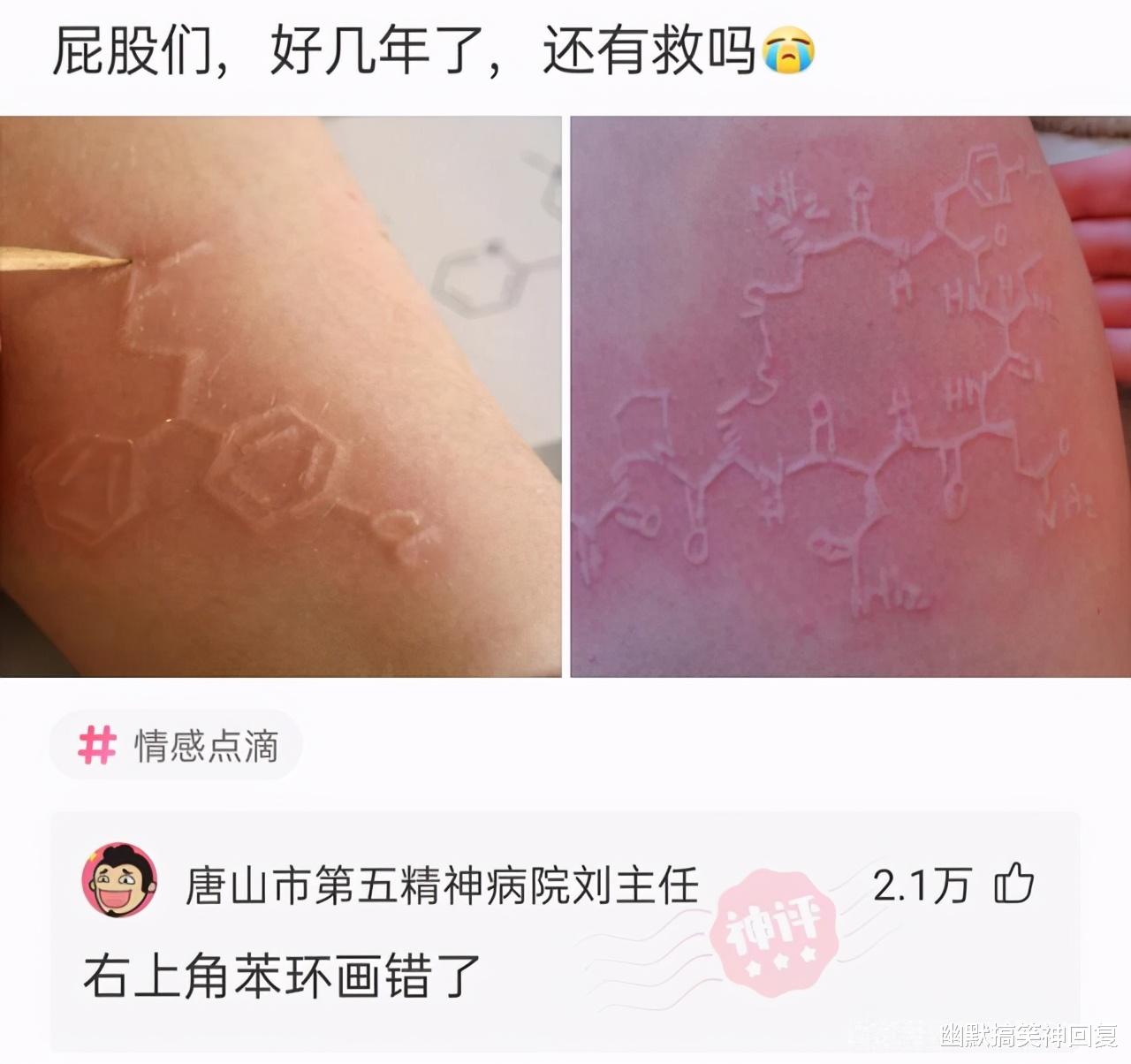 幽默搞笑神回复|神回复：“手臂出现奇怪图纹，我还有救吗？”网友：难道变异了？